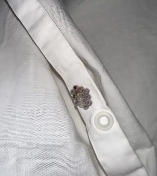 Jag hittade de här små bollarna i min säng och fick mitt livs chock: Jag ska berätta vad de var.