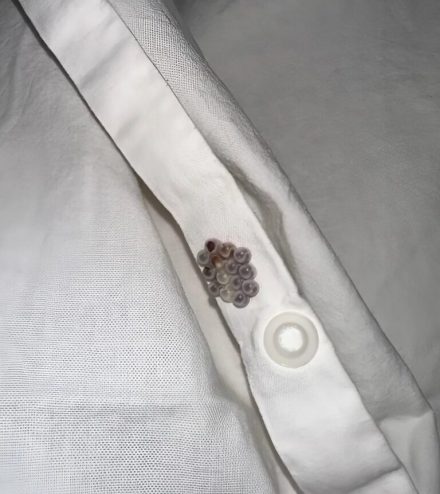 Jag hittade de här små bollarna i min säng och fick mitt livs chock: Jag ska berätta vad de var.