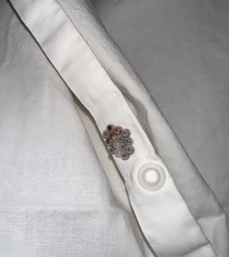 Jag hittade de här små bollarna i min säng och fick mitt livs chock: Jag ska berätta vad de var.