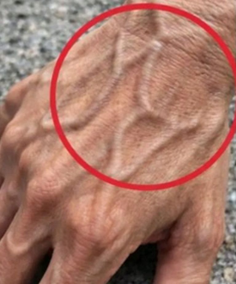 🖐️Om dina handvener är synliga, här är vad din kropp kan säga dig