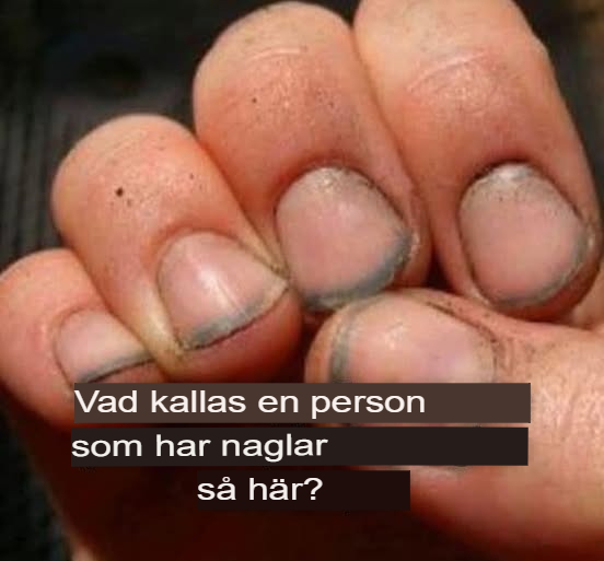Vad kallar man en person som har sådana naglar?