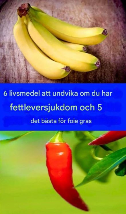 6 livsmedel att undvika om du har fettleversjukdom och 5 livsmedel som rekommenderas om du har fettleversjukdom