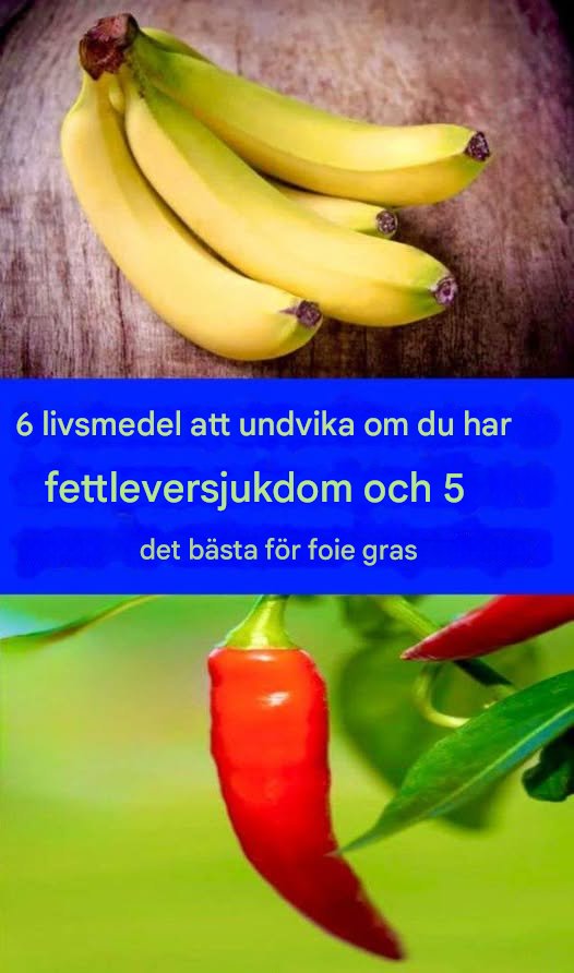 6 livsmedel att undvika om du har fettleversjukdom och 5 livsmedel som rekommenderas om du har fettleversjukdom