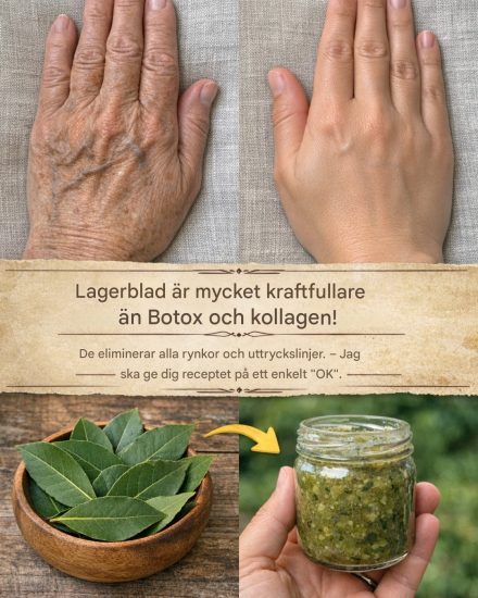 Lagerblad är mycket kraftfullare än Botox och kollagen! De drar ut alla rynkor och ansiktslinjer. Jag behöver att du säger något för att fortsätta få mina recept.🙏
