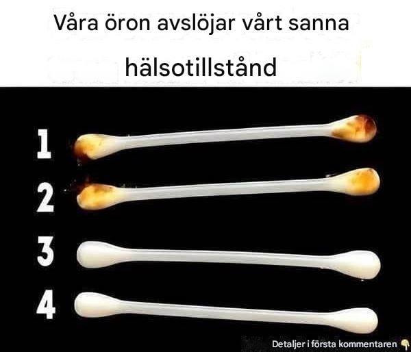 Vad dina öron kan avslöja om din hälsa