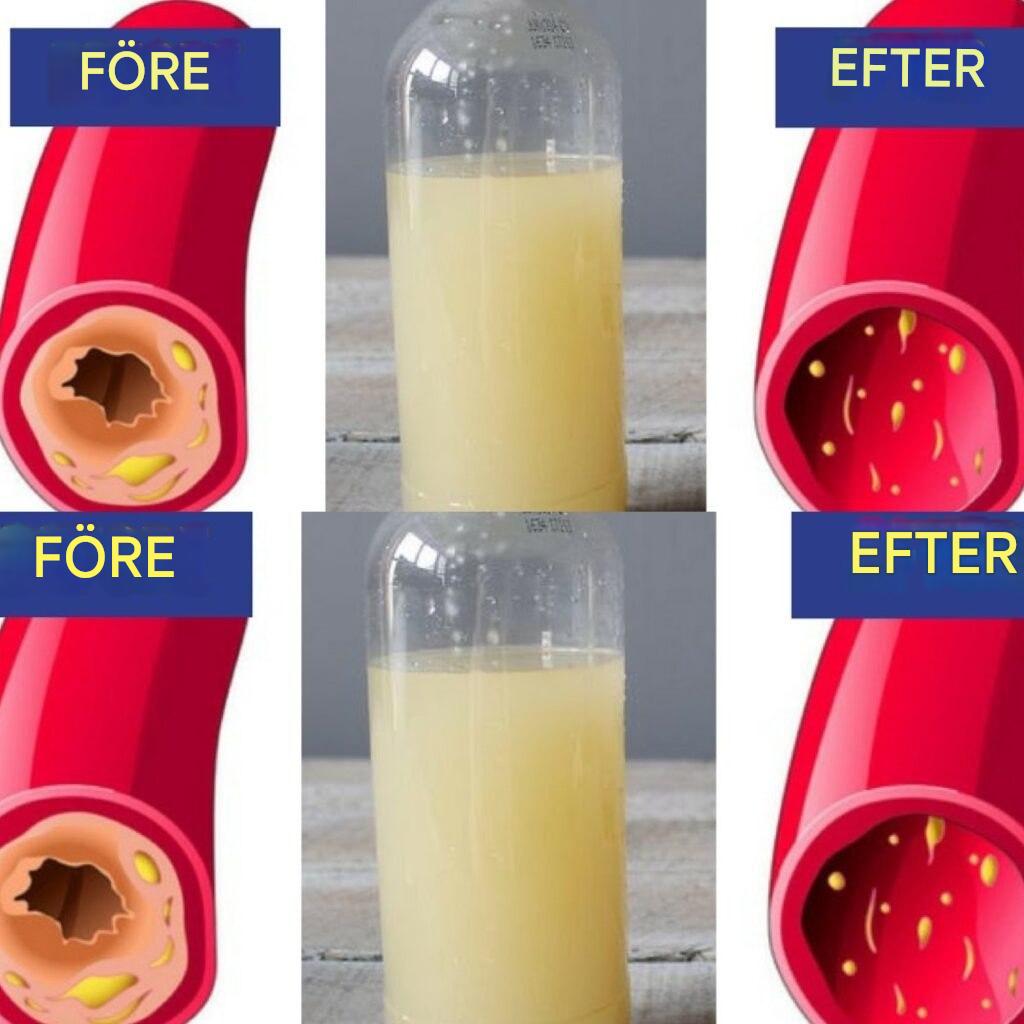 Ett naturligt elixir för ditt hjärta: Citron, vitlök och vatten