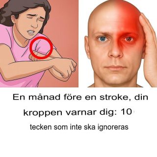 En månad före en stroke varnar din kropp dig: 10 tecken att inte ignorera