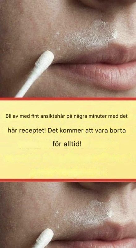 Detta naturliga recept tar bort ansiktshår permanent.