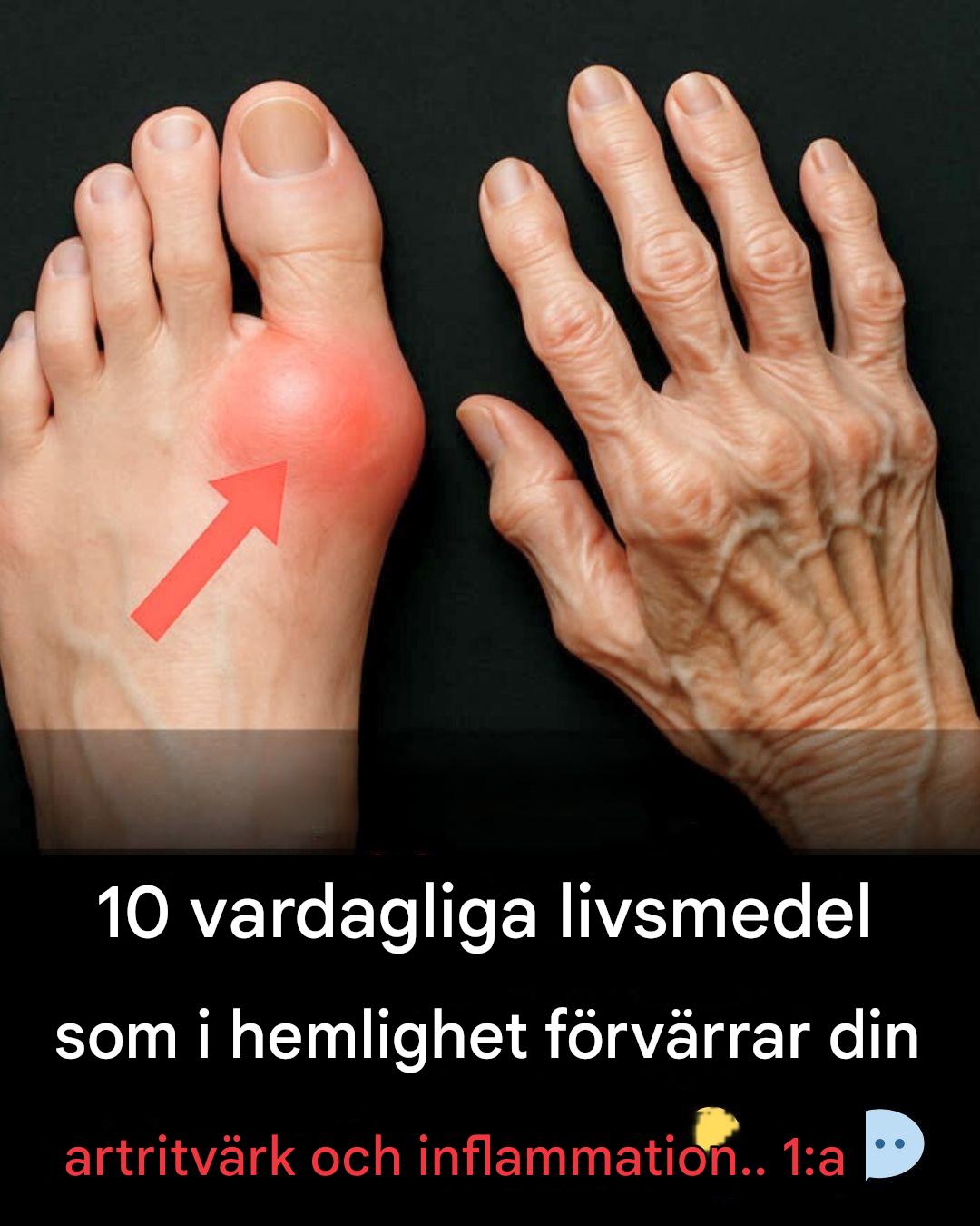 Varning för artrit: 10 vardagliga livsmedel som förvärrar din smärta och inflammation