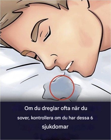 Orsaker till dreglande medan du sover