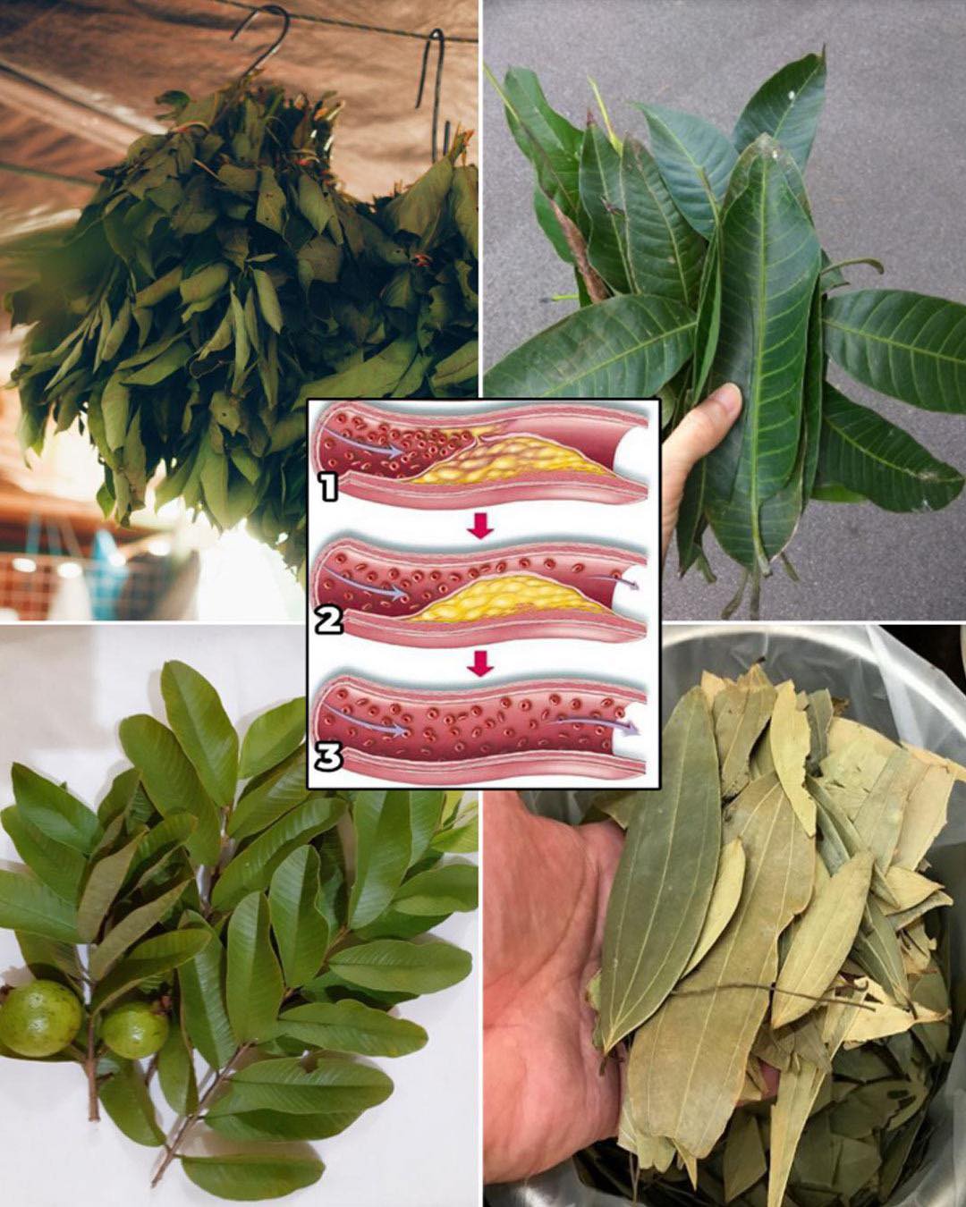 De fyra medicinska bladen: Avokadoblad, mangoblad, lagerblad och guavablad