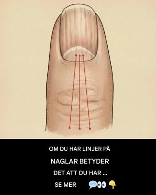 Linjer på dina naglar: Vad de kan avslöja om din hälsa