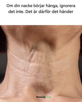 Om din nacke börjar hänga, ignorera det inte. Det är därför det händer.