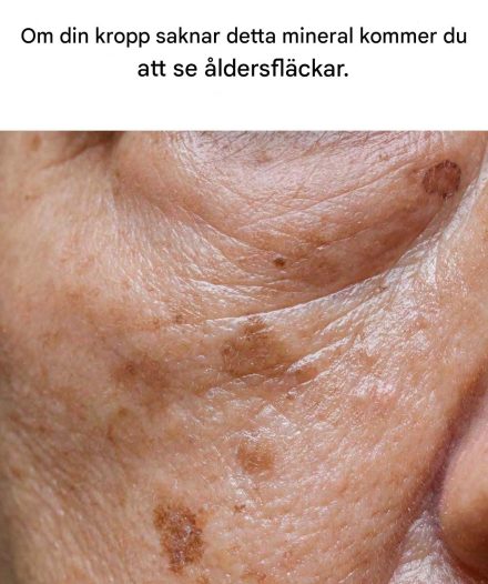 Brist på detta mineral ökar risken för åldersfläckar.