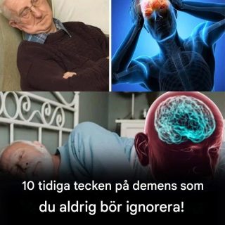 10 tidiga tecken på demens som du aldrig bör ignorera