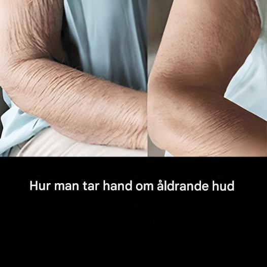 Hur man tar hand om åldrande hud