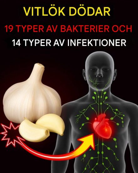 Är det sant att vitlök dödar 14 typer av bakterier och 13 typer av infektioner?