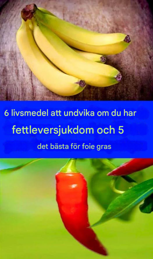 6 livsmedel att undvika om du har fettleversjukdom och 5 livsmedel som rekommenderas om du har fettleversjukdom