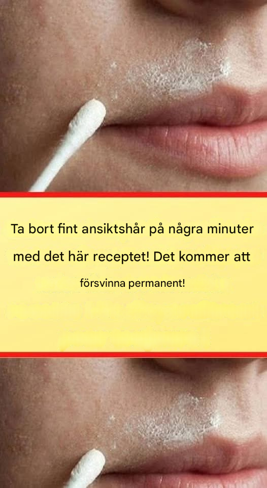 Detta naturliga recept låter dig permanent ta bort ansiktshår.