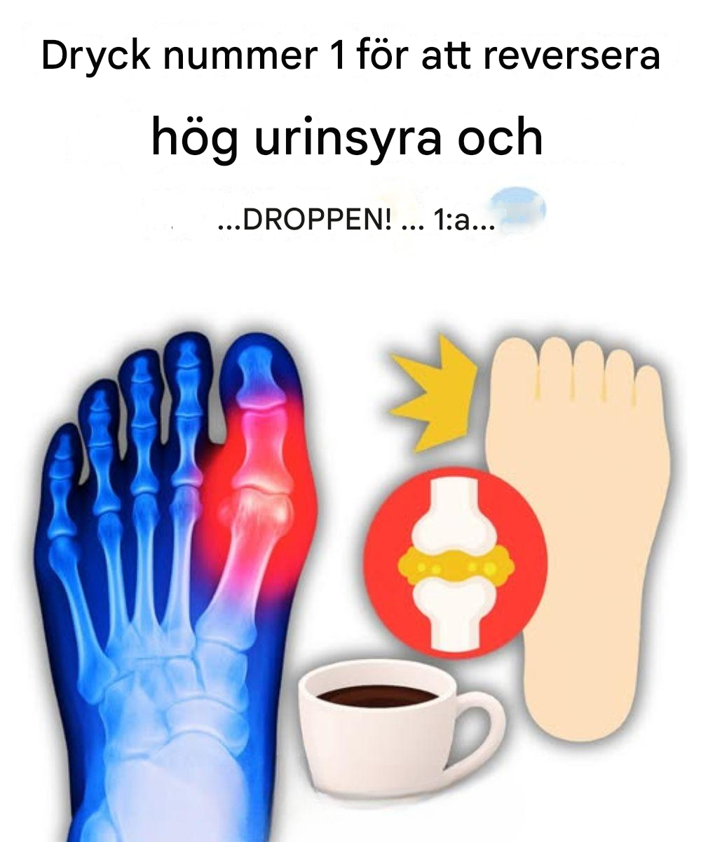 “Min stortå brann… tills jag upptäckte dessa 5 drycker som naturligt eliminerar urinsyra!”