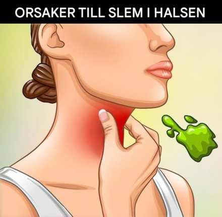 De verkliga orsakerna till konstant slem och slem i halsen och hur man blir av med det