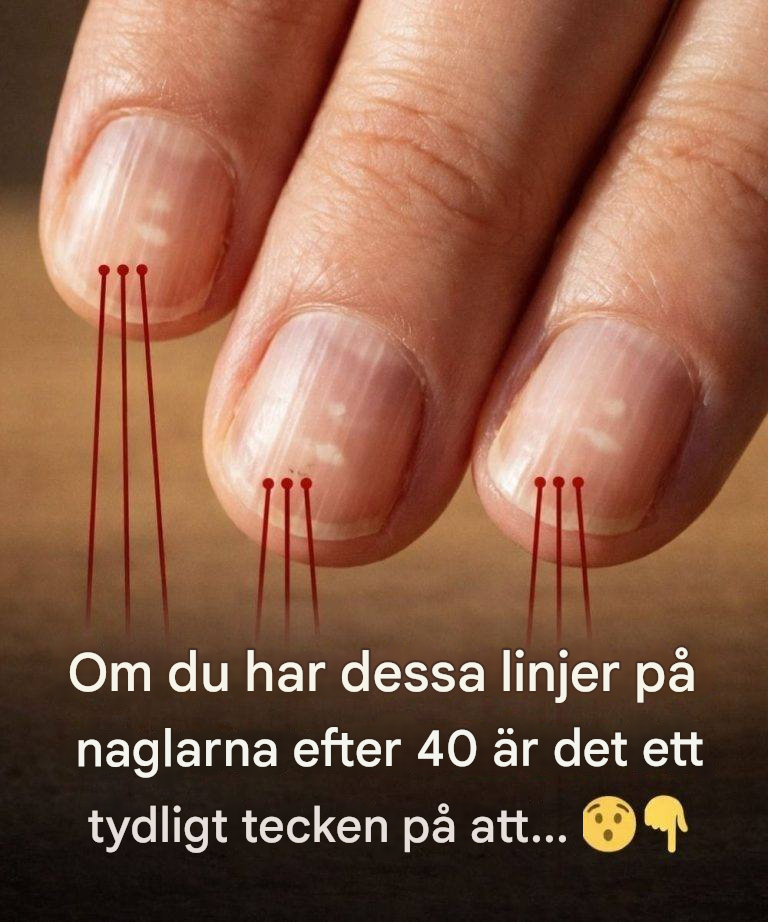 Livsmedel som stärker naglarna efter 40