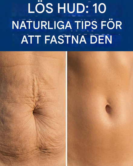 10 sätt att naturligt stärka huden efter viktminskning
